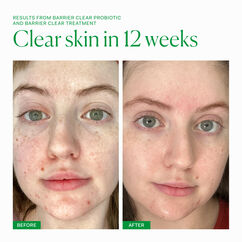 Barrier Clear Treatment, , large, image7