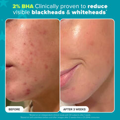 Smoothing Superstars, , large, image2