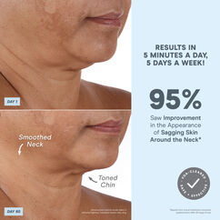 Nuface Mini + Starter Kit- Sandy Rose, SANDY ROSE , large, image3