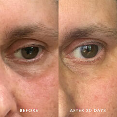 Niacinamide & Caffeine Eye Bright Cream, , large, image5