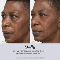 TheraFace PRO- Black, , large, image4