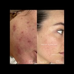 Supernatural Blemish Face Serum, , large, image9