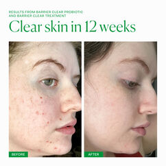 Barrier Clear Probiotic, , large, image6