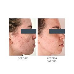 Violet Water BHA Clarifying Treatment Tonic, , large, image6