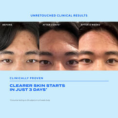 Biome-Balancing Clear & Prevent Blemish Treatment Serum, , large, image3