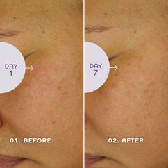 Bio Retinoid Youth Serum, , large, image5