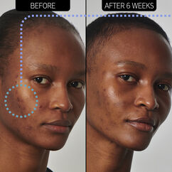 SuperSolutions 20% Niacinamide Serum, , large, image4