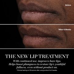 Lip Treatment, ROSE, large, image11