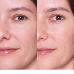 Dewtopia 25% Acid Flash Facial Mask, , large, image10