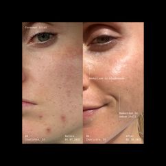 Supernatural Blemish Face Serum, , large, image7