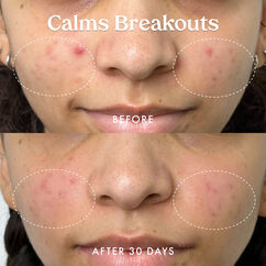 Star Bright Vitamin C Moisturizer, , large, image8