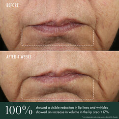 Advanced Lip Perioral Serum, , large, image6