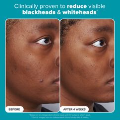 Skin Perfecting 2% BHA Liquid Exfoliant, , large, image6