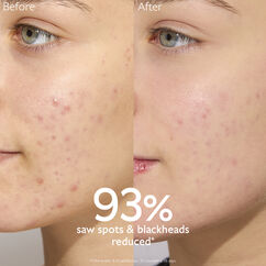 Vinopure Oil-Control Moisturiser for Acne Prone Skin, , large, image4