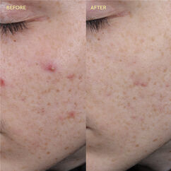 Blemish Clearing Paste, , large, image4