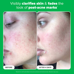 10% Azelaic Acid Booster, , large, image5