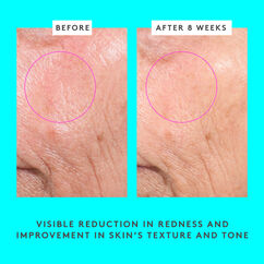 Bouncy Brightfacial&trade;, , large, image5