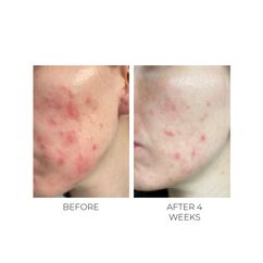 Violet Water BHA Clarifying Treatment Tonic, , large, image5