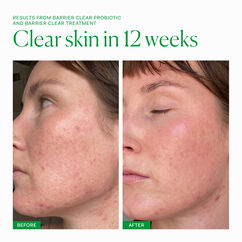 Barrier Clear Probiotic, , large, image8