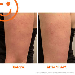 ExfoliKate Resurfacing Body Scrub, , large, image4