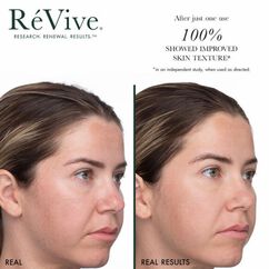 Masque de Brilliance Resurfacing Multi-Acid Mask, , large, image9