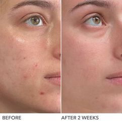 Alpha Beta&reg; 2% BHA Liquid Solution, , large, image9