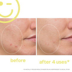 Mega-C&trade; 30% Vitamin C Brightening Facial, , large, image5