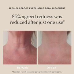 Retinol Reboot Exfoliating Body Treatment, , large, image5