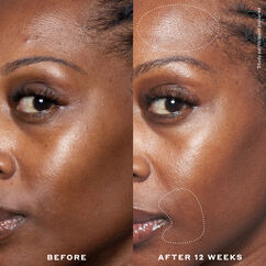 Double Rewind 0.3% Pro-Grade Retinol Serum, , large, image5