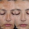 The Hyperpigmentation Serum, , large, image3
