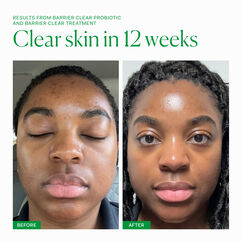 Barrier Clear Probiotic, , large, image7