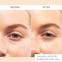 Skin Remedy Soothing Eye Gels, , large, image4