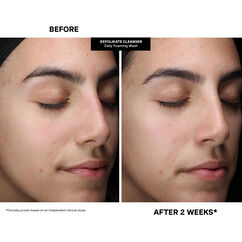 Pore-fect Skin Edit, , large, image4