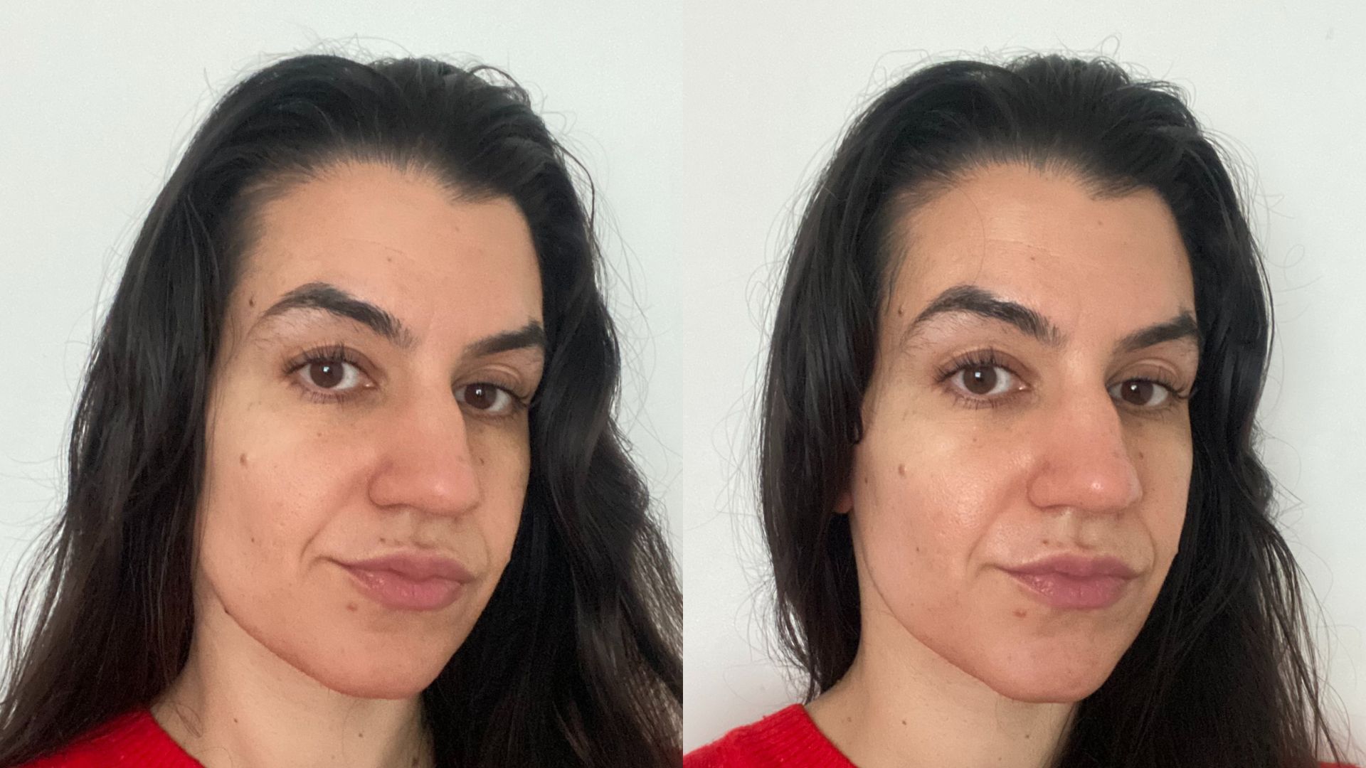 Medik8 Advanced Liquid Peptides before and after Medik8 Advanced Liquid Peptides before and after