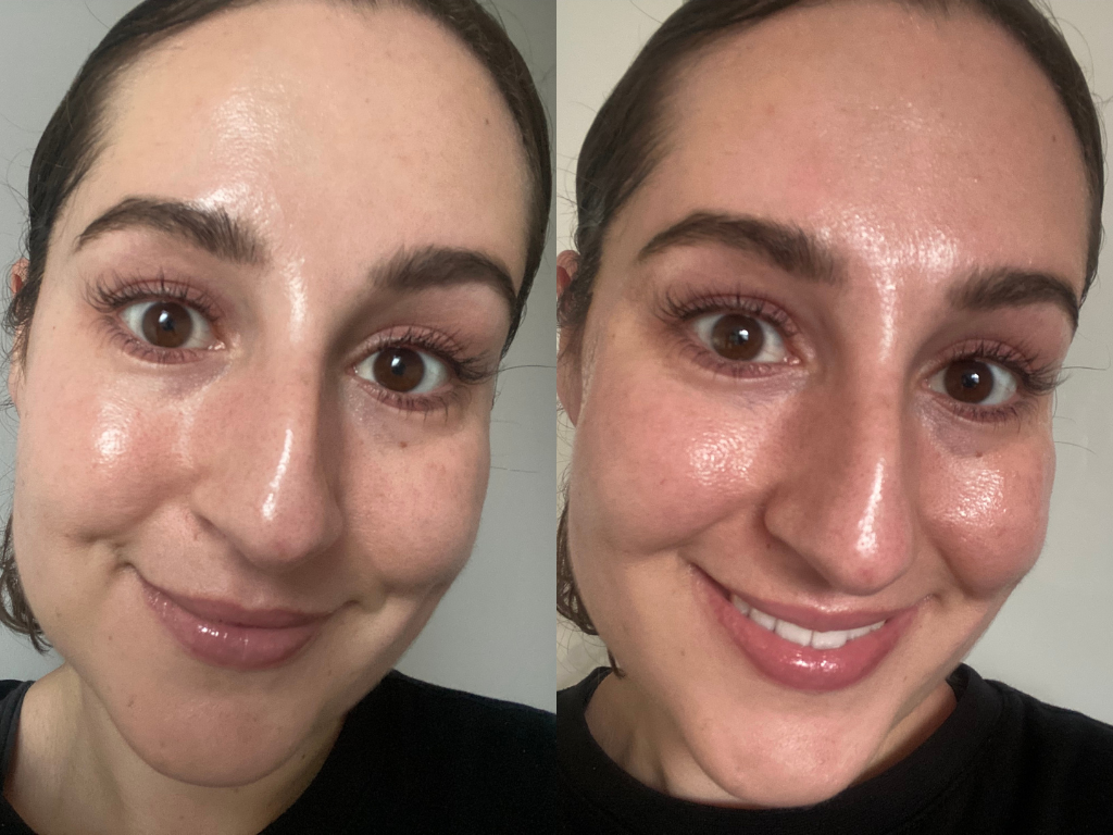 Dr Dennis Gross DermInfusions Eye Mask Before and After | Space NK Dr Dennis Gross DermInfusions Eye Mask Before and After | Space NK
