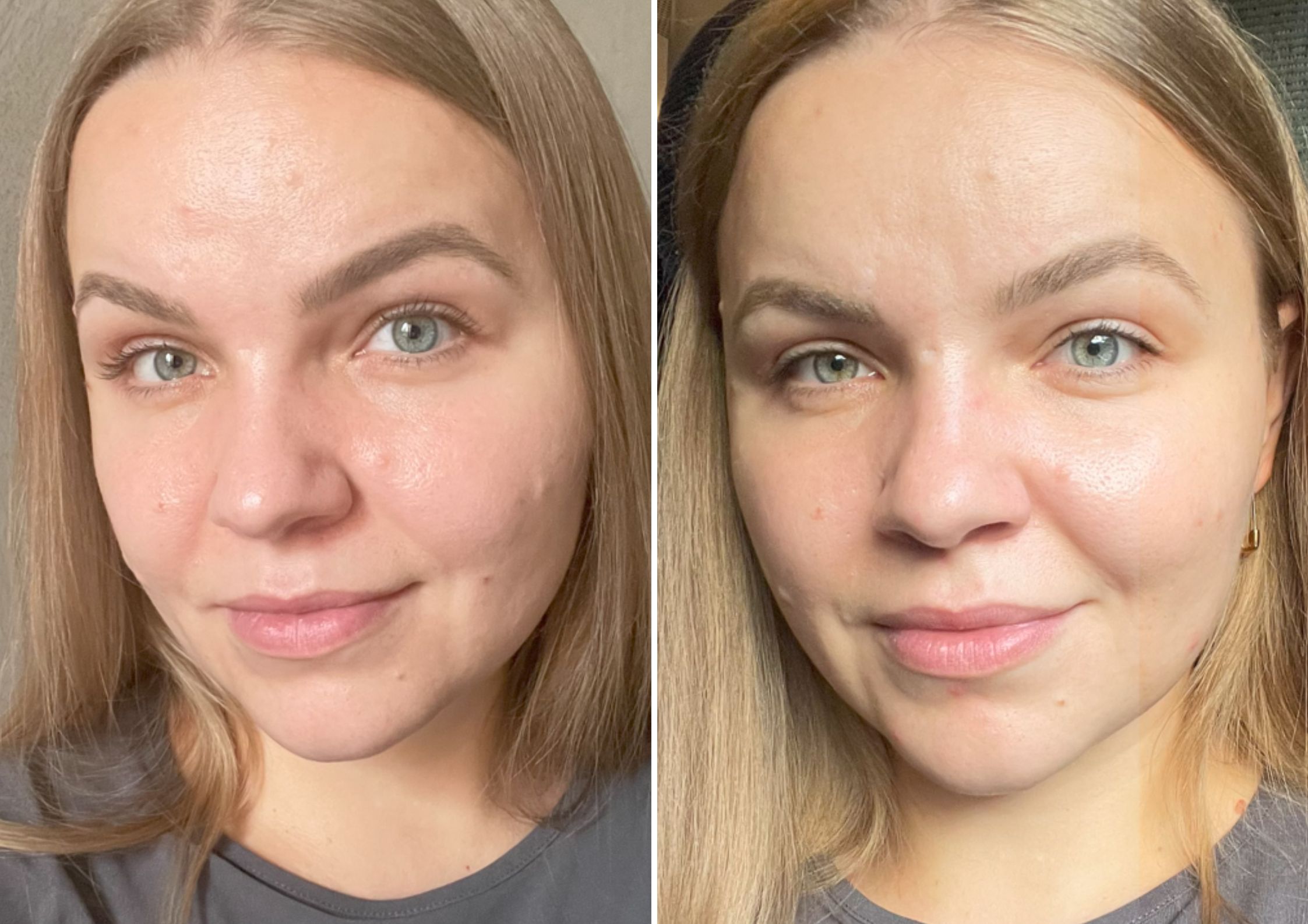 Violetta's Medik8 Advanced Pro-Collagen Peptide Cream Review Violetta's Medik8 Advanced Pro-Collagen Peptide Cream Review