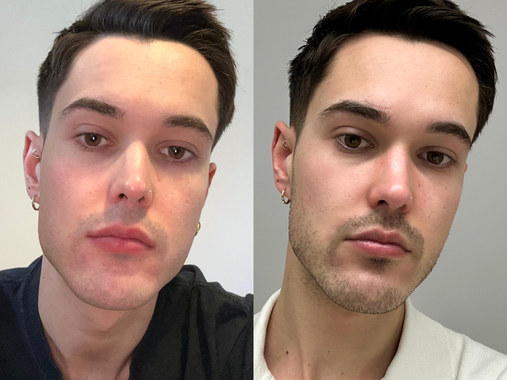 Before and after Drunk Elephant Bora Barrier Repair Cream | Space NK Before and after Drunk Elephant Bora Barrier Repair Cream | Space NK