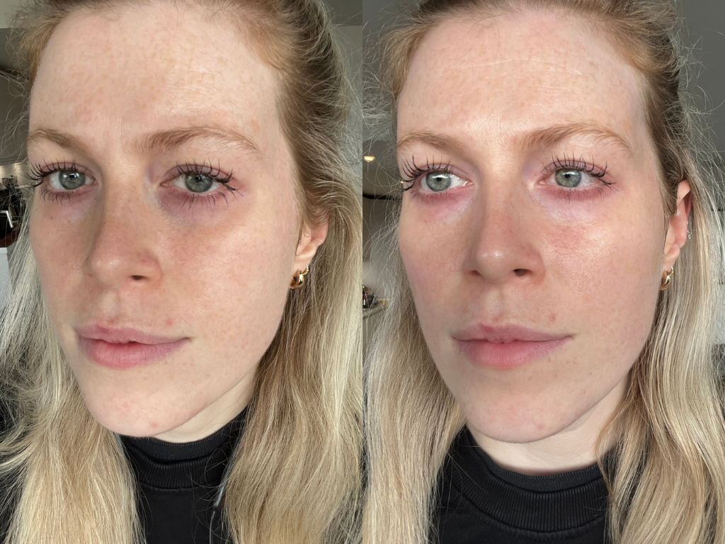 Dr Dennis Gross DermInfusions Eye Mask Before and After | Space NK Dr Dennis Gross DermInfusions Eye Mask Before and After | Space NK