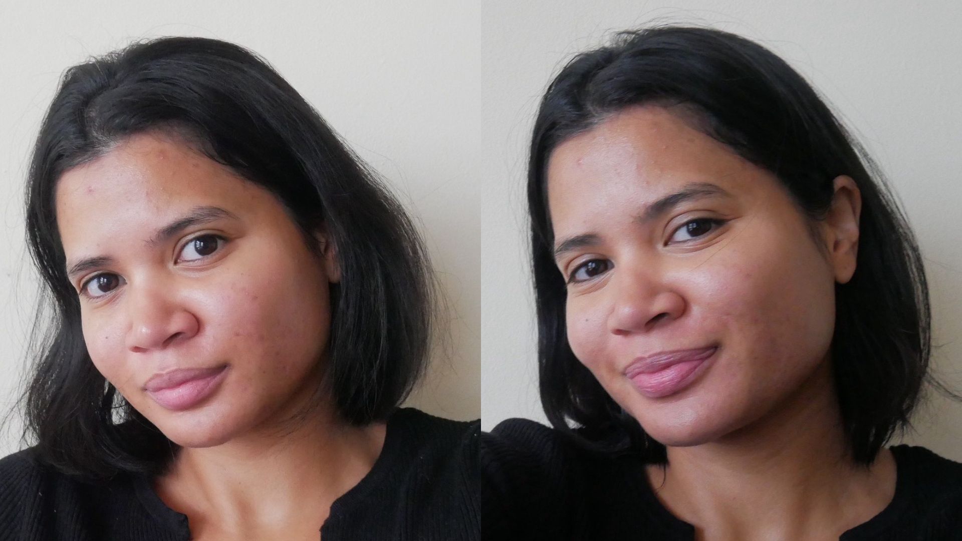 Hanitra before and after using The Ordinary Multi-Active Delivery Essence | Space NK Hanitra before and after using The Ordinary Multi-Active Delivery Essence | Space NK