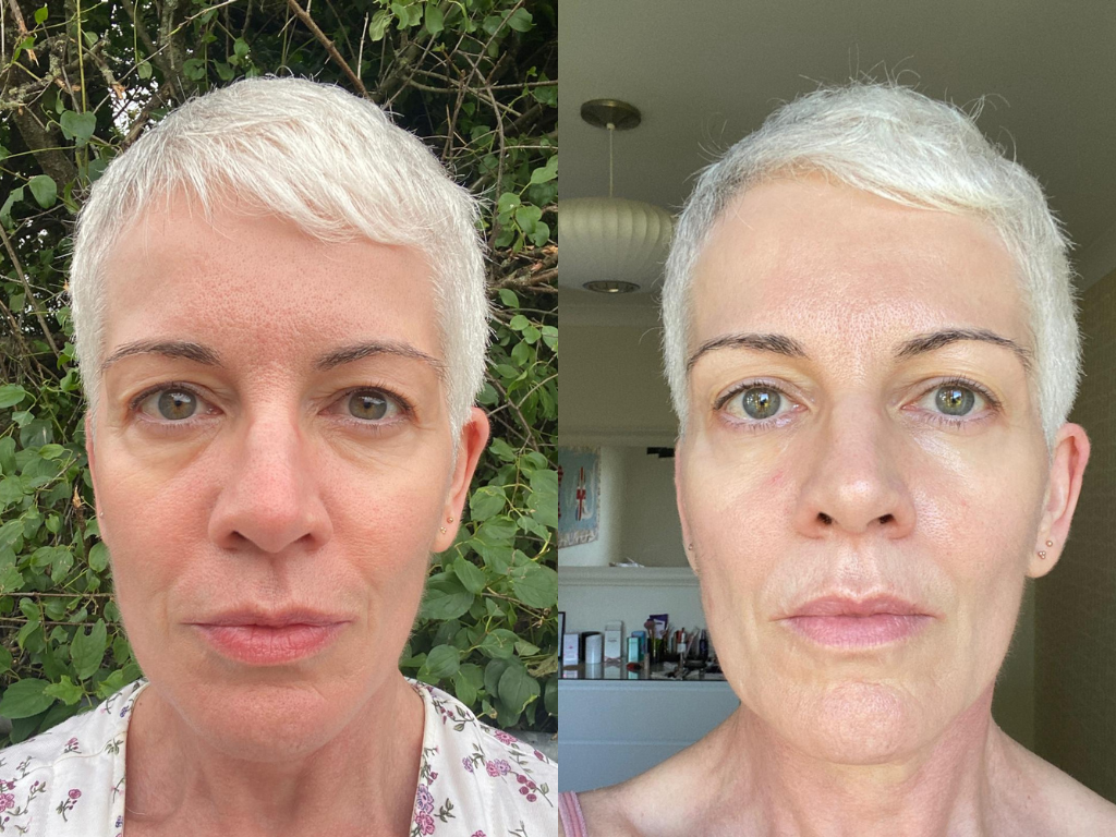 Before and after Medik8 Crystal Retinal 20 Serum | Space NK