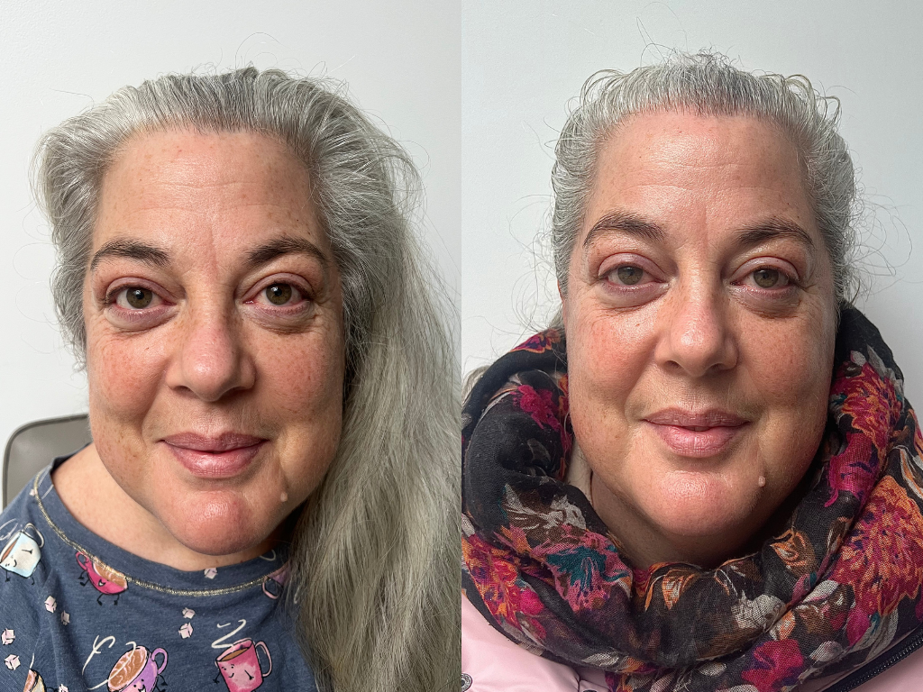 Before and after Skin Rocks The Rich Moisturiser | Space NK Before and after Skin Rocks The Rich Moisturiser | Space NK