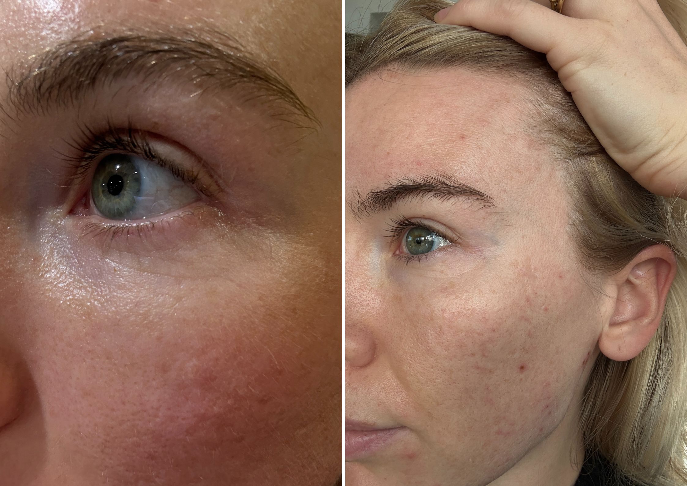 Georgia's Medik8 Advanced Pro-Collagen Peptide Cream Review 1 Georgia's Medik8 Advanced Pro-Collagen Peptide Cream Review 1