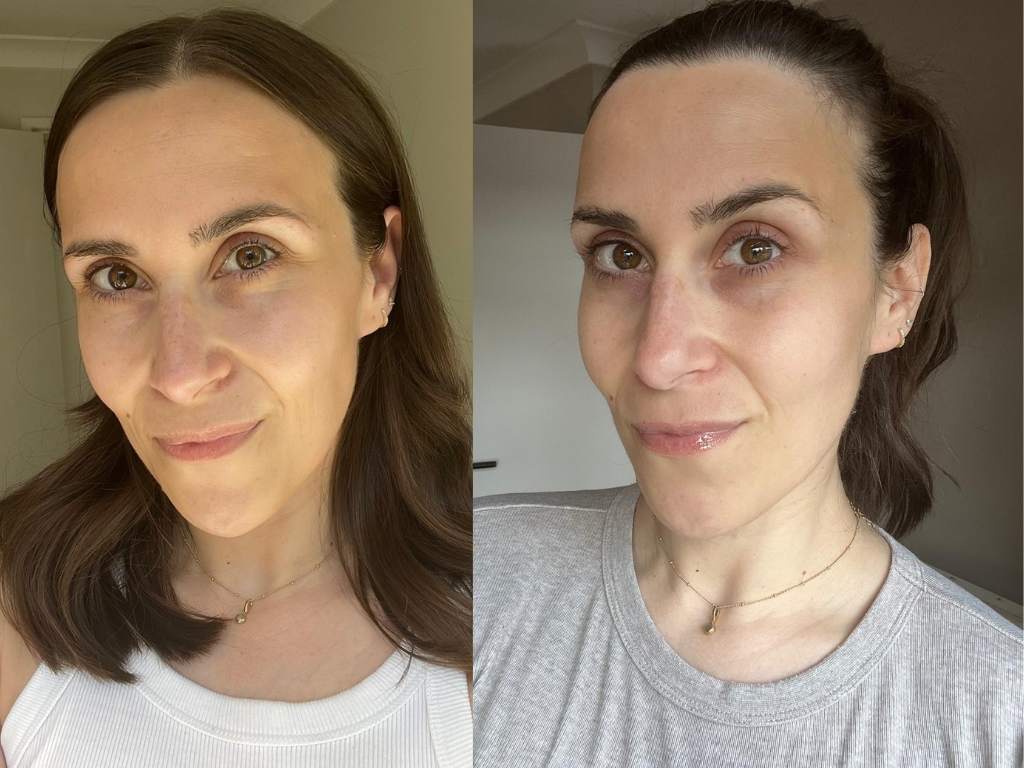 Before and after Medik8 Crystal Retinal 20 Serum | Space NK