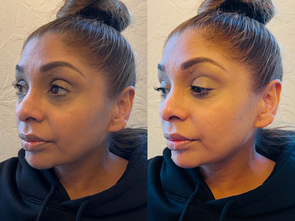 Before and after Tatcha SPF | Space NK Before and after Tatcha SPF | Space NK