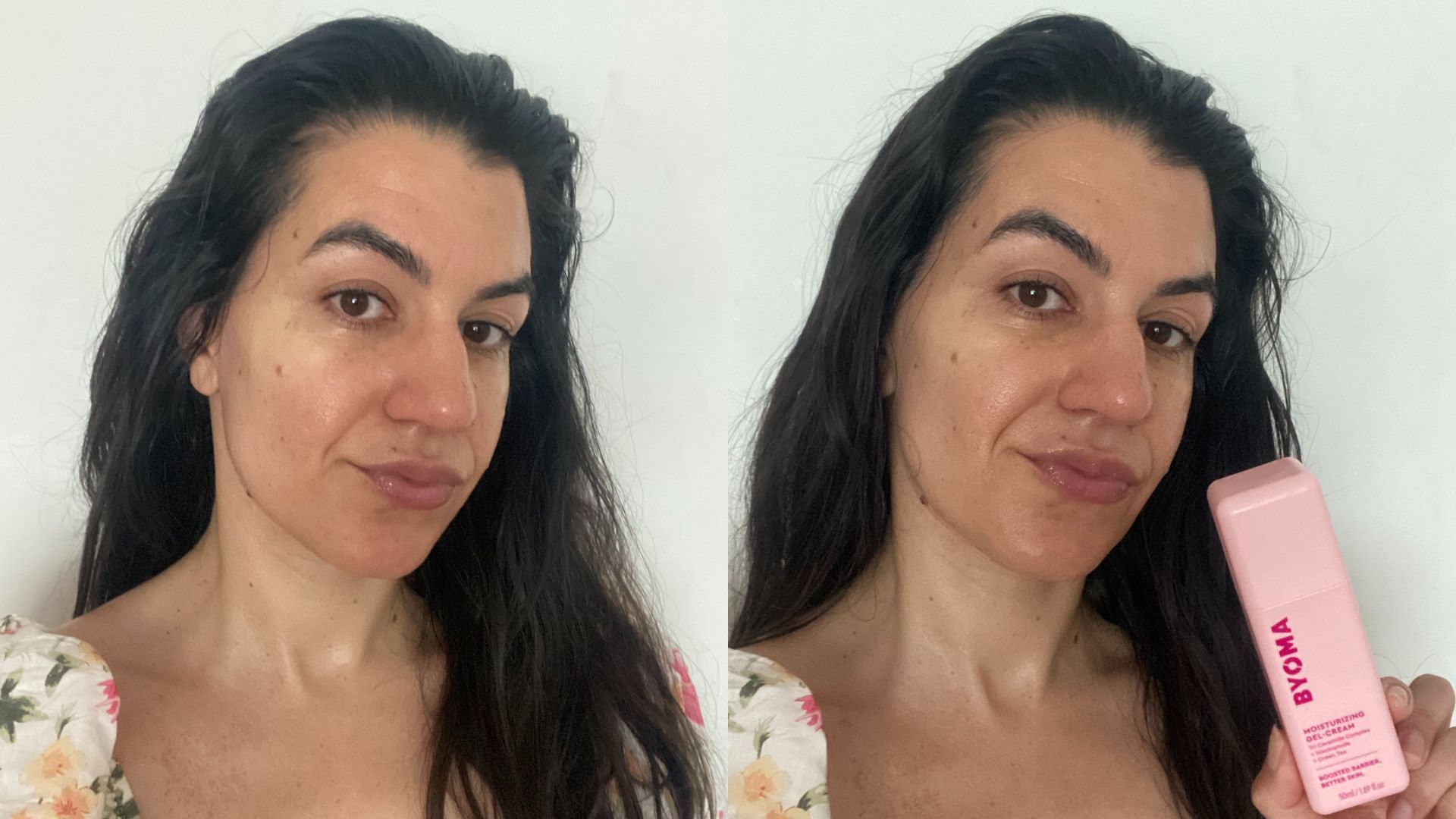 Vanessa before and after using Byoma Moisturising Gel Cream | Space NK Vanessa before and after using Byoma Moisturising Gel Cream | Space NK