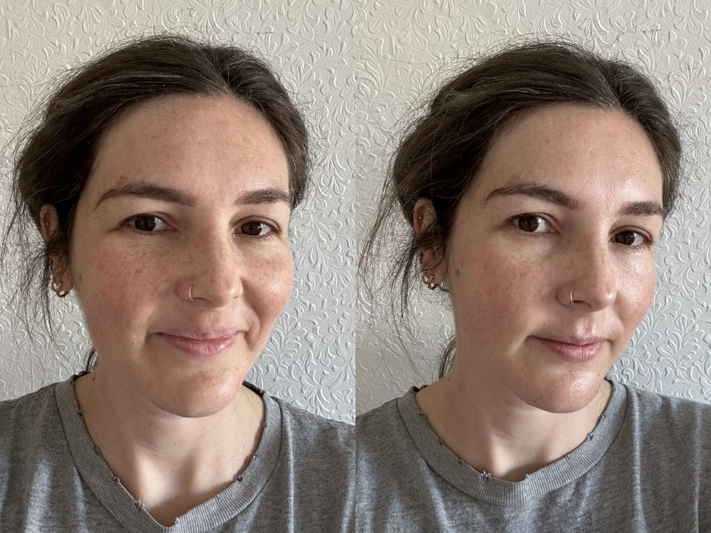 Before and after Dr Barbara Glow Cream | Space NK Before and after Dr Barbara Glow Cream | Space NK