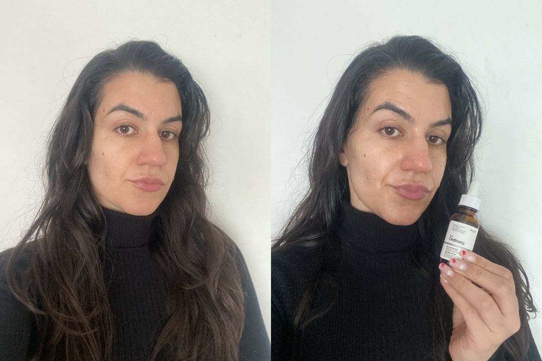 The Ordinary GF 15% Solution Before and After