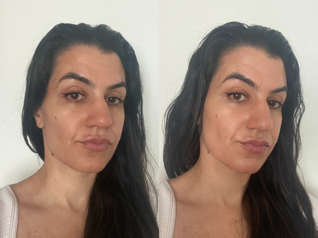 Before and after photos of Charlotte Tilbury Unreal Skin Foundation | Space NK Before and after photos of Charlotte Tilbury Unreal Skin Foundation | Space NK