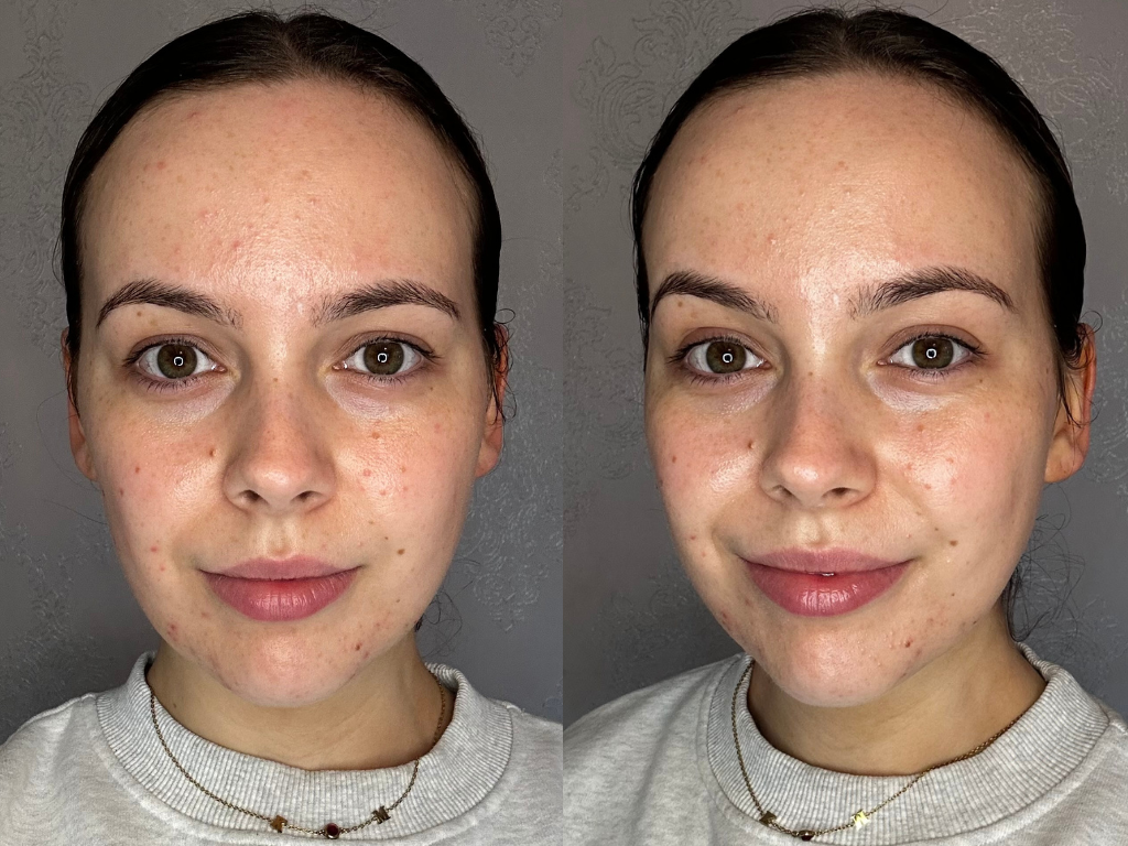 Before and after Dr Barbara Glow Cream | Space NK Before and after Dr Barbara Glow Cream | Space NK