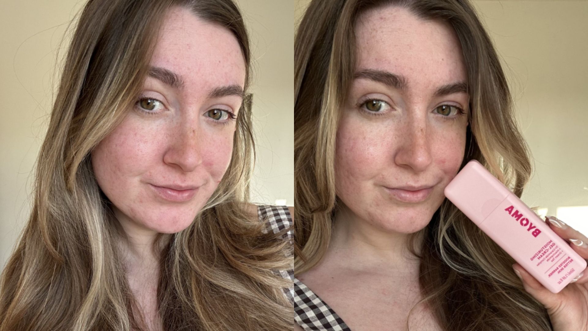 Shawnee before and after using Byoma Moisturising Gel Cream | Space NK Shawnee before and after using Byoma Moisturising Gel Cream | Space NK